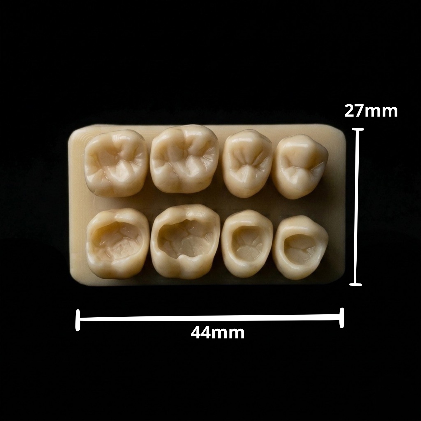 Posterior Bundle