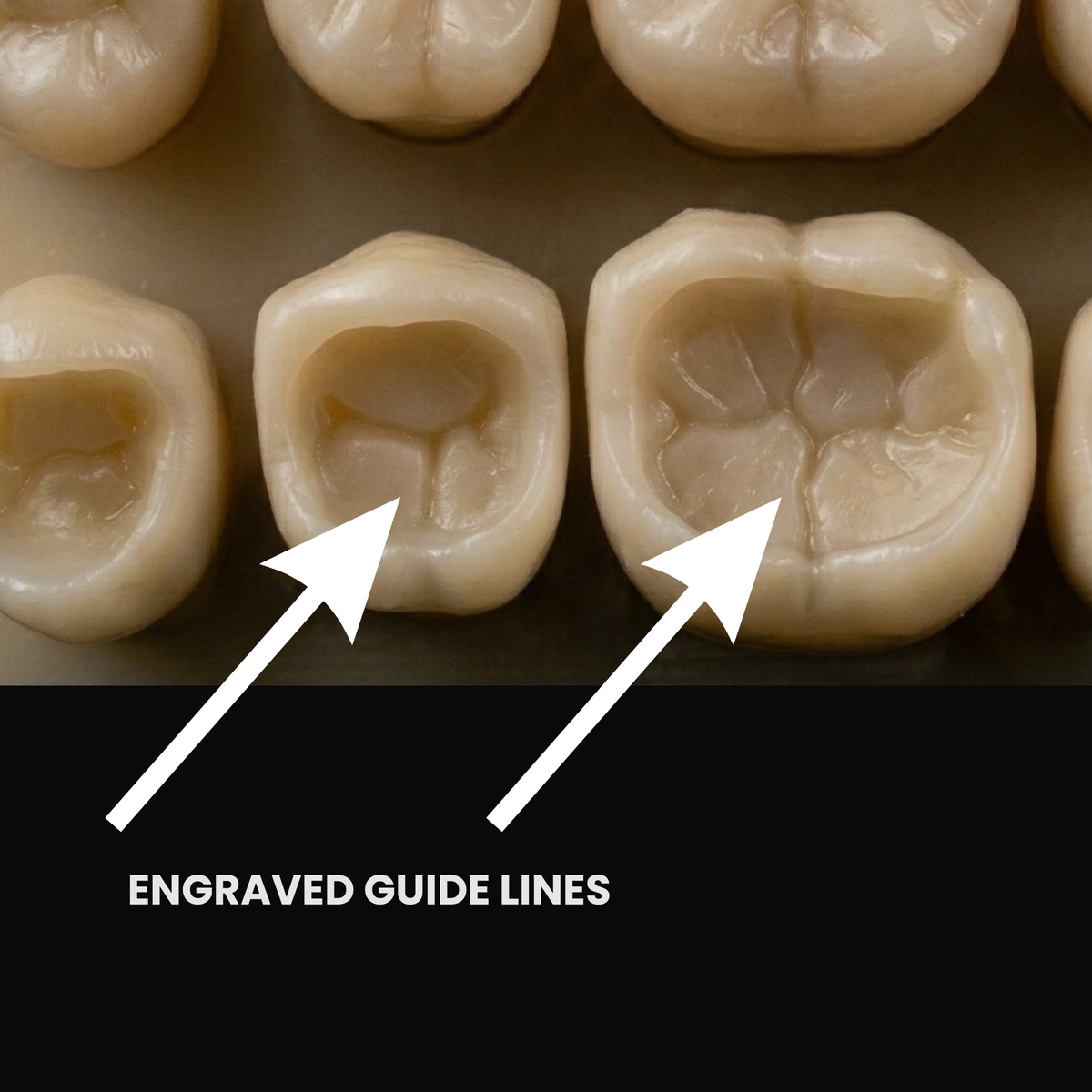 Posterior Path Bundle