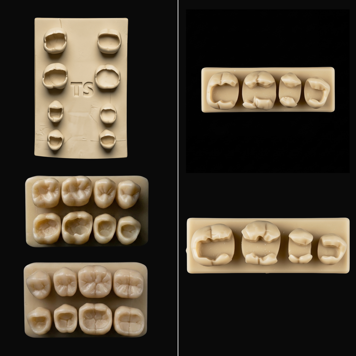 Posterior Path Bundle