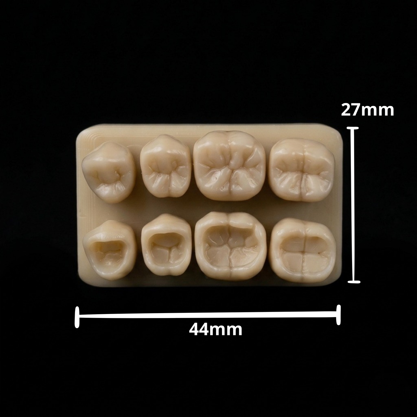 Posterior Bundle