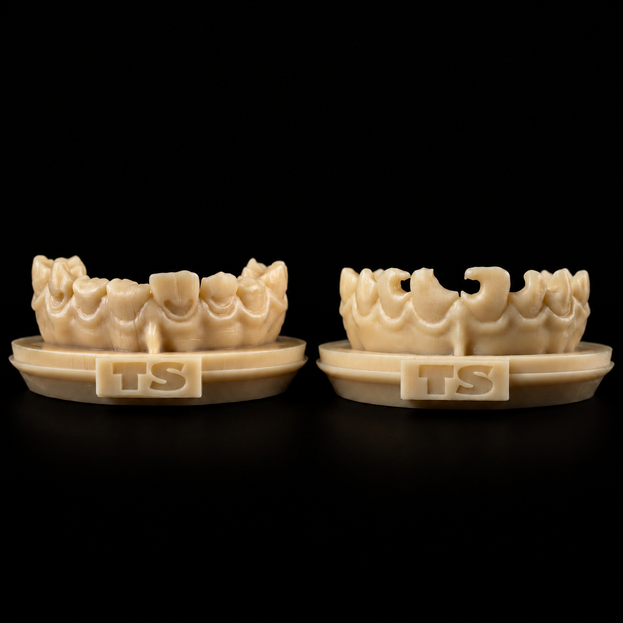 Anterior Bundle