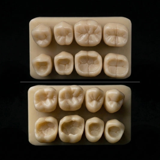 Posterior Bundle